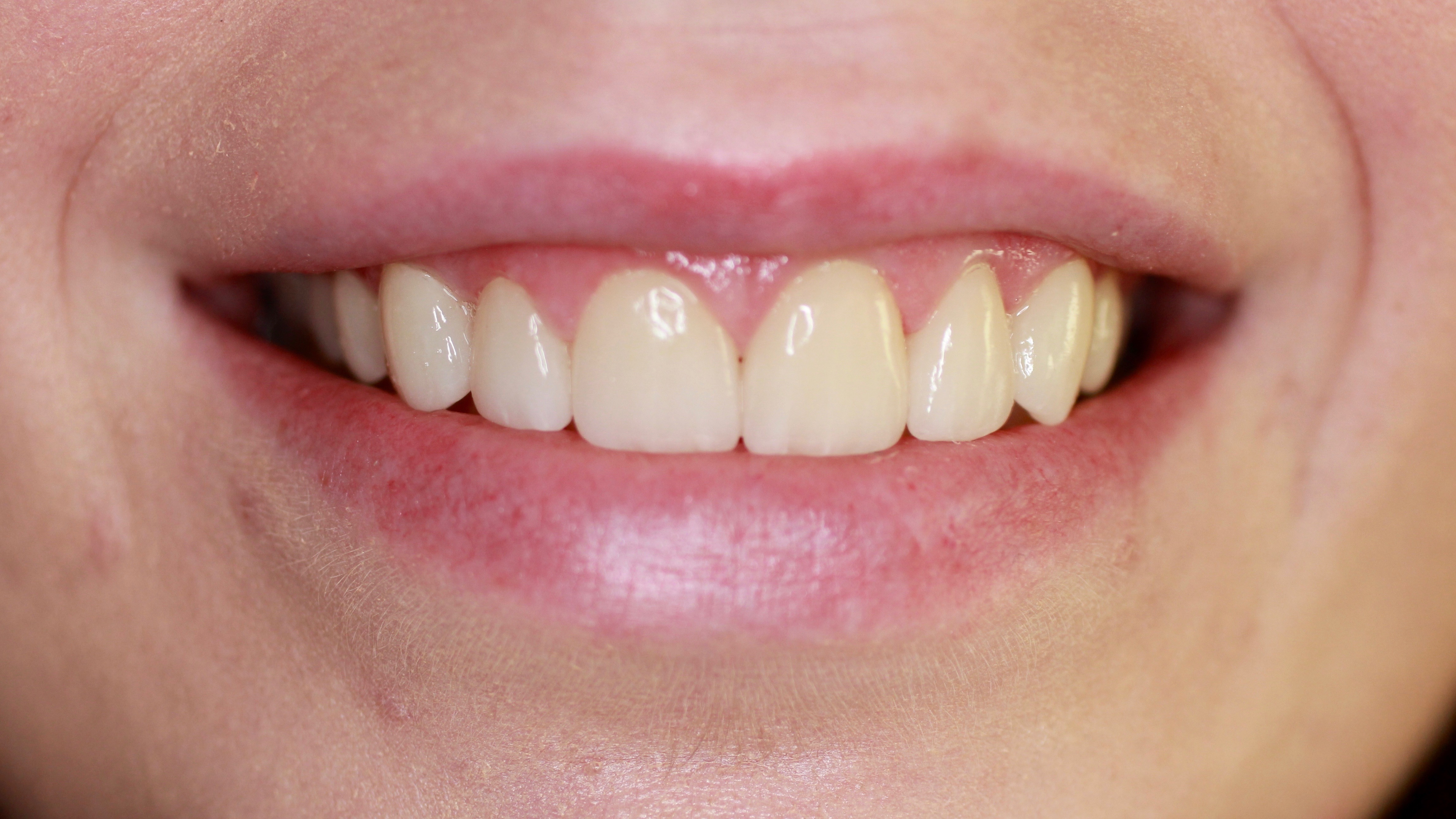 Megan 2 Tempe Dental Care
