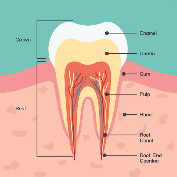 Dental Cavities